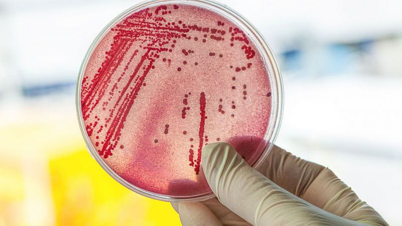 Вспышка E. coli приостановила работу армянского молочного предприятия