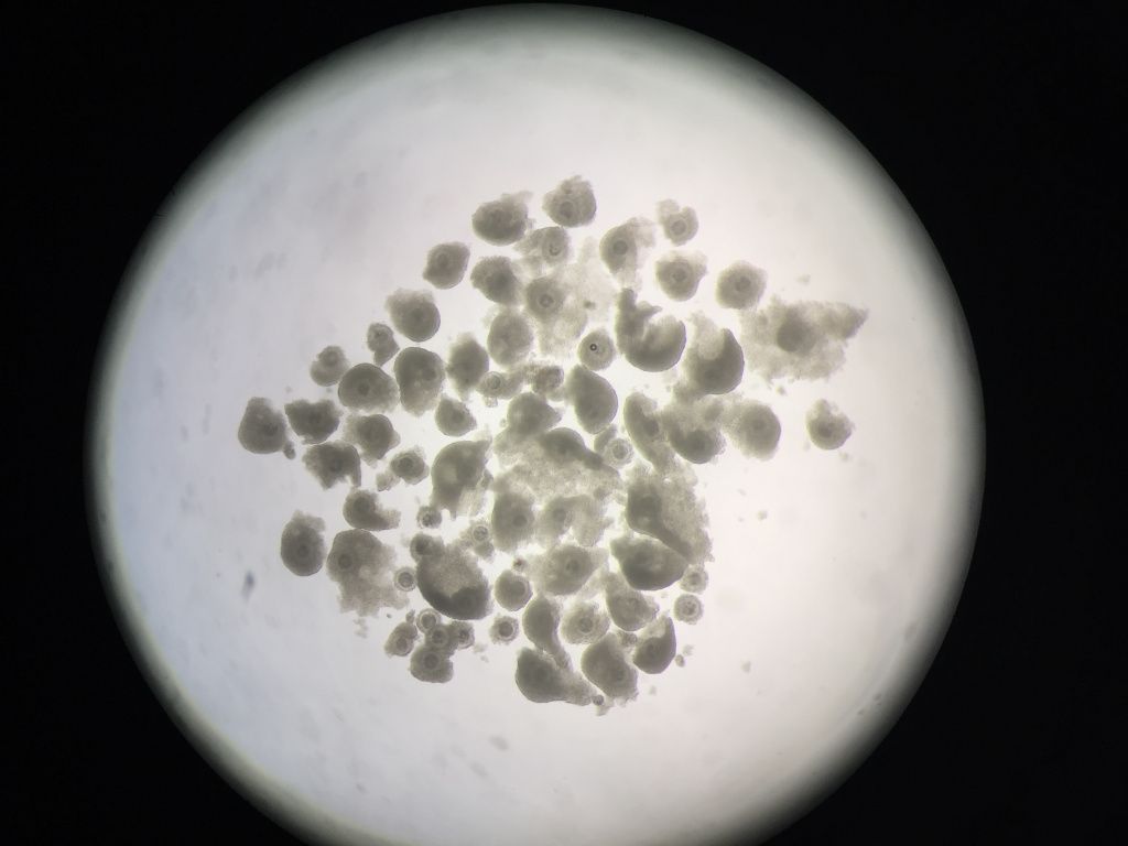 Manhattan HO 66 Oocytes 15SE16 (1).JPG